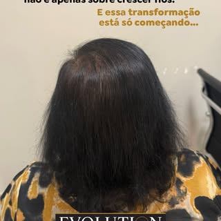 6 meses de evolução e a diferença já é evidente! ✨

Mais densidade, mais força e uma transformação q