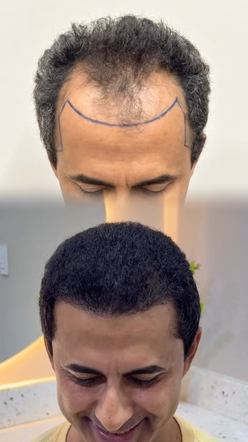 O resultado começa a aparecer, mas a transformação ainda não terminou ✨

Confira o antes e depois de