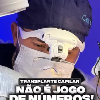 A melhor área doadora continua sendo a própria cabeça, porque os fios são mais fortes e parecidos co