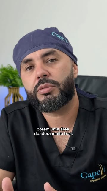 Muita gente acredita que o tamanho da calvície é o que define a dificuldade do transplante, mas o fa