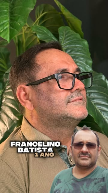 O Francelino Batista veio de Uruará para realizar o transplante capilar com a gente. Antes de tomar 