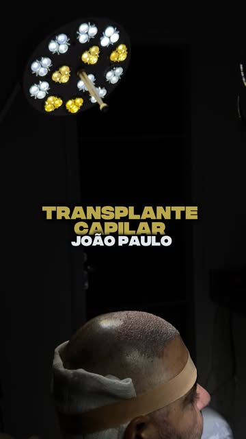 MAIS UM TRANSPLANTE CONCLUÍDO 

Hoje foi a vez do João Paulo, de Santarém.

Um caso em que cada área
