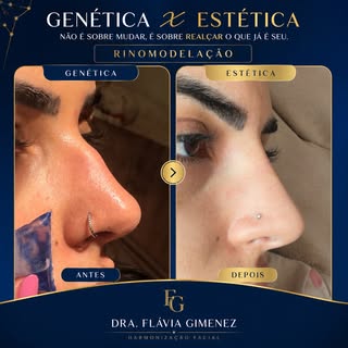 ✨ GENÉTICA x ESTÉTICA

A genética define características únicas que fazem parte da nossa identidade.