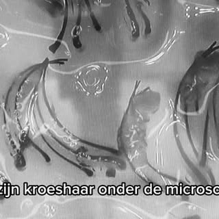 Kroeshaar onder de microscoop 

Heb jij je ooit afgevraagd hoe kroeshaar eruitziet onder een microsc