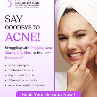 Acne Treatment in Adambakkam | Acne & Acne Scar Treatment in Chennai

Dealing with pimples, acne mar