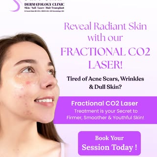 Fractional CO2 Laser Treatment in Adambakkam | Acne Scar Treatment in Chennai

Looking to improve th