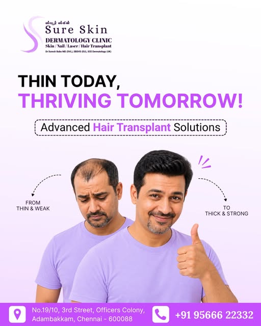 Hair Transplant in Chennai | Restore Your Hair & Confidence ✨

Struggling with hair thinning, recedi