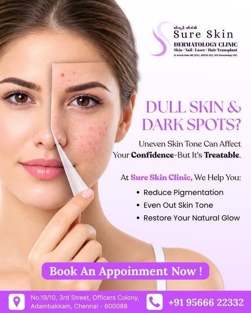 Pigmentation Treatment in Chennai | Dark Spots & Uneven Skin Tone Treatment in Adambakkam

Dull skin