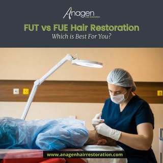 The hair transplant has become a widely popular aesthetic procedure. Follicular unit transplantation