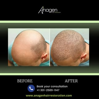 Call us at (301) 589-1147 for a free consultation today! Virtual consultations and quotes are availa