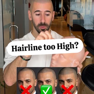 DON’T go too high with your hairline 🚫. Natural is always the right choice, but going too conservat
