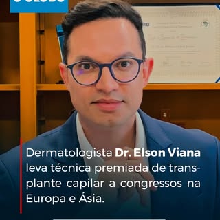 🇧🇷 Saiu no O Globo: nossa técnica premiada de transplante capilar, a Optimized Nonshaven FUE, foi 