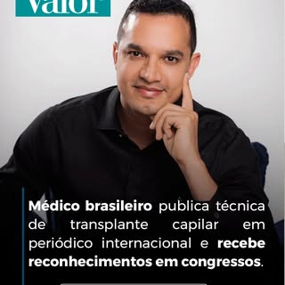 🇧🇷 Saiu no Valor Econômico: nossa técnica de transplante capilar, a Optimized Nonshaven FUE, publi