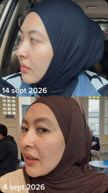 Ketika kulit ngerasa mulai kering, garis halus mulai ganggu. Warna kulit jg terasa lebih gelap. Lang