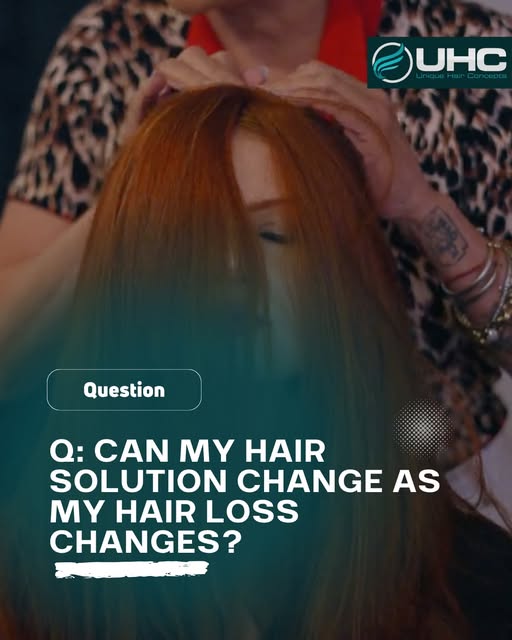 **Yes, and sometimes it should.**

Hair loss isn't always static. Your density, coverage needs, scal