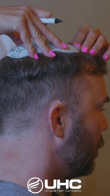 Considering a CNC Hair System but still deciding if it's right for you?

Take a look at Ryan's exper