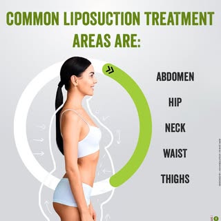 💠 Targeted Liposuction for a Refined You 💠
Common treatment areas: Abdomen, Hips, Neck, Waist & Th