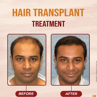 Regain your confidence with expert hair transplant treatment at Charutar Hospital—safe, advanced, an