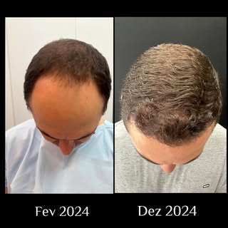 É maravilhoso realizar sonhos e acompanhar uma evoluçæo dessas após 10 meses( resultado parcial).
Ob