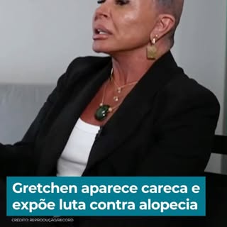 O transplante capilar feminino ganhou destaque nos últimos dias com o caso da Gretchen, mas esse ass
