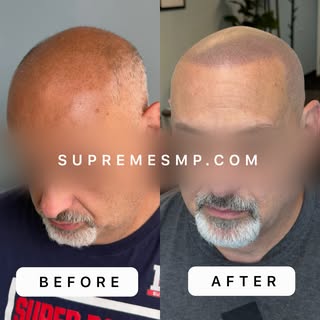 If you’re looking for a premium, top-tier SMP treatment, look no further. We’re the real deal!

Just