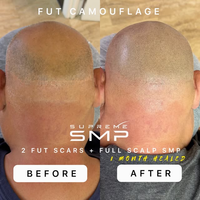 THIS IS NOT JUST A COSMETIC TATTOO.

What looks simple on the surface is actually one of the most te