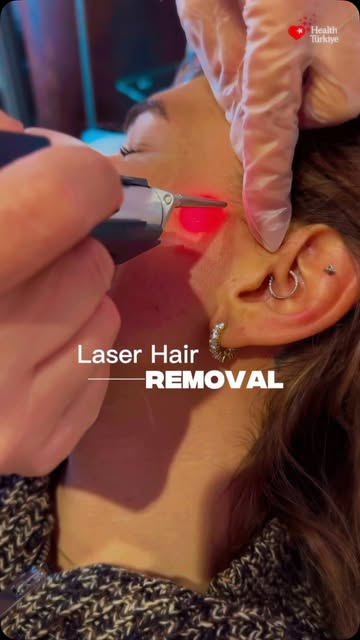 Laser Hair Removal with Alexandrite Technologies at Dr. Huseyin Guner beauty 💕

Patient consent was