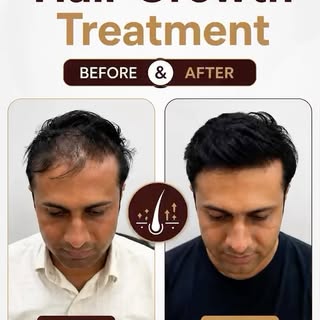 ✨ Stronger Roots. Healthier Hair. Better Confidence.

Hair fall doesn’t have to define your look. Ou