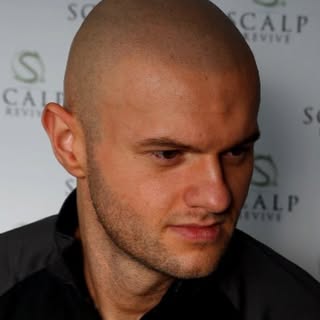 Scalp Revive 
Offering Trico pigmentation & Scalp Micro Pigmentation #hairloss #scalprevive #smp #le