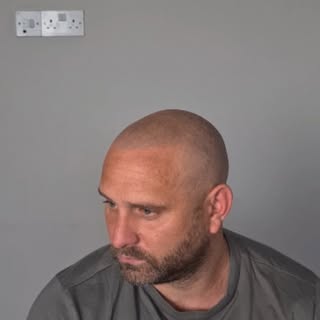 Scalp Revive Leeds