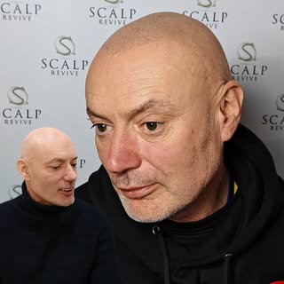Scalp Revive Hairloss Clinic Leeds. Soft faded natural hairline blended into the sides with no side 