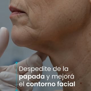 El gran desafío clínico en la estética facial y corporal es revertir la flacidez sin recurrir a ciru