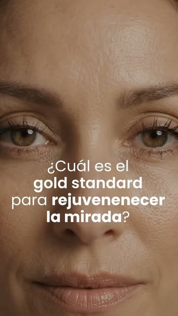 Casi nunca opero un párpado solo.

Cuando una paciente llega diciendo que le sobra piel arriba, lo p