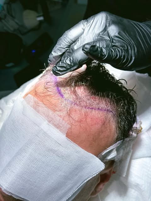No Shave înseamnă mai multă discreție, fără să renunți la aspectul actual al părului.

Prin această 