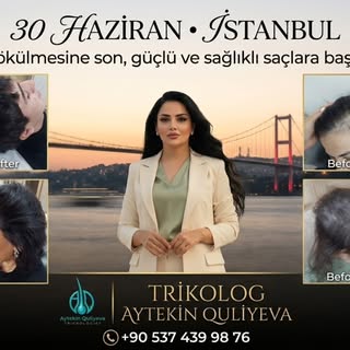 Saç Sağlığı ve Tedavileri

30 Haziran’da İstanbul’dayız. 

‼️Sadece kadın danışanlara/hastalara özel