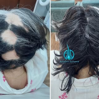 Saçlarını illərin təcrübəsinə etibar et, təsadüfi müalicələrə yox....

+994706295104
www.trixoloq.az