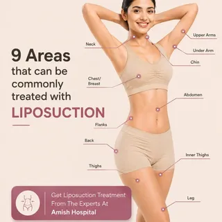 Your body, your confidence. 💫

Swipe to see the 9 key areas commonly treated with liposuction in Wh