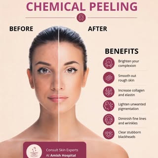 Chemical peeling at Amish Hospital targets uneven texture, pigmentation, fine lines, and stubborn bl