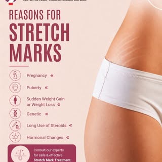 Ever wondered why stretch marks appear? From pregnancy and weight changes to genetics and hormones, 
