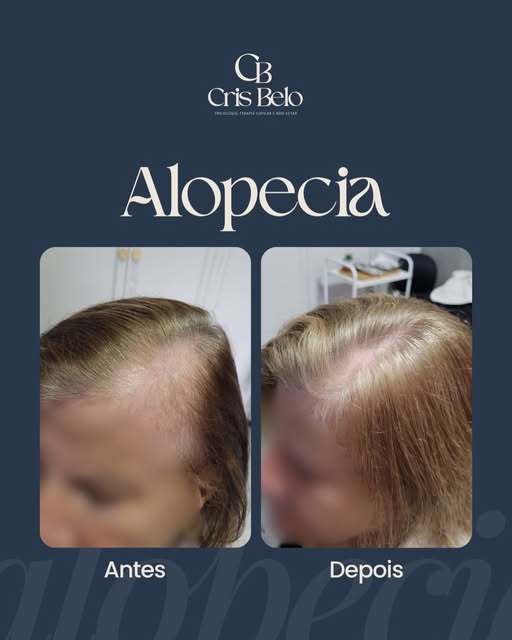 No início, ela já tinha percebido que alguma coisa estava diferente.

O cabelo estava mais fino, o c