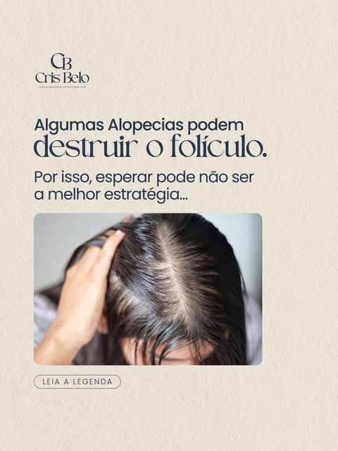 Nem toda queda de cabelo significa apenas “queda”. Em algumas alopecias, o processo pode comprometer