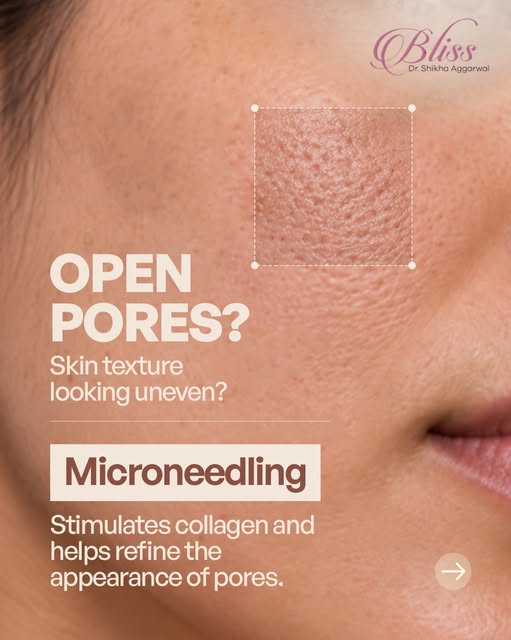 Flawless skin isn’t a secret—it’s science. ✨ 

Whether you are battling stubborn acne scars, dullnes