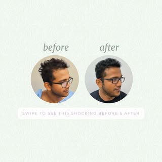Swipe to see this incredible before-and-after journey, where confidence and natural results meet. 💇