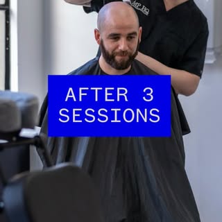 After your Scalp Micropigmentation treatment, sit back and enjoy the confidence that comes with it. 