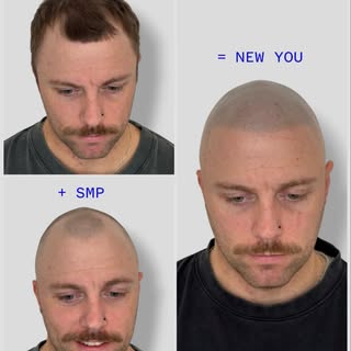 Shaving your head isn’t giving up. It’s a power move. (especially when SMP fills in what the clipper