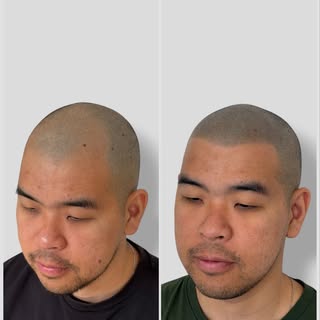 Most people won’t notice what changed.
But you’ll know.

That’s the goal.

Natural hairline.
Seamles