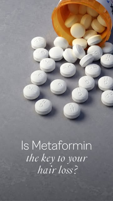 You might not expect a diabetes drug to show up in a hair loss conversation — but metformin is getti