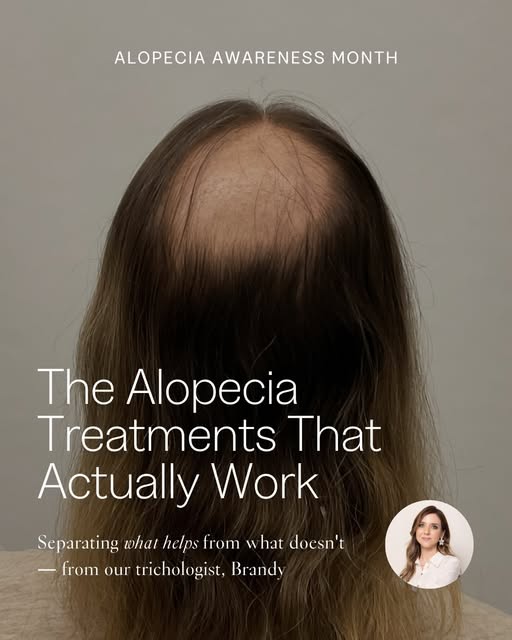 Alopecia areata affects nearly 7 million Americans, and it’s not one condition with one fix. 

Waiti
