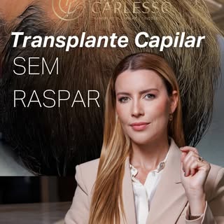 ✨ Transplante capilar sem raspar é possível. ✨

No Instituto Carlesso, realizamos transplante com fi