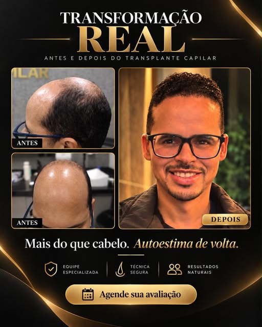 Transformação de auto estima concluída com sucesso ✅

Paciente Leandro realizou sua cirurgia de Tran